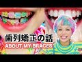 KAWAII BRACES !! ”Haruka Kurebayashi” | Eng Sub