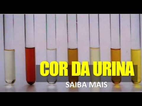 A COR DA URINA E SUA SAÚDE - Dr. Marcelo Lima
