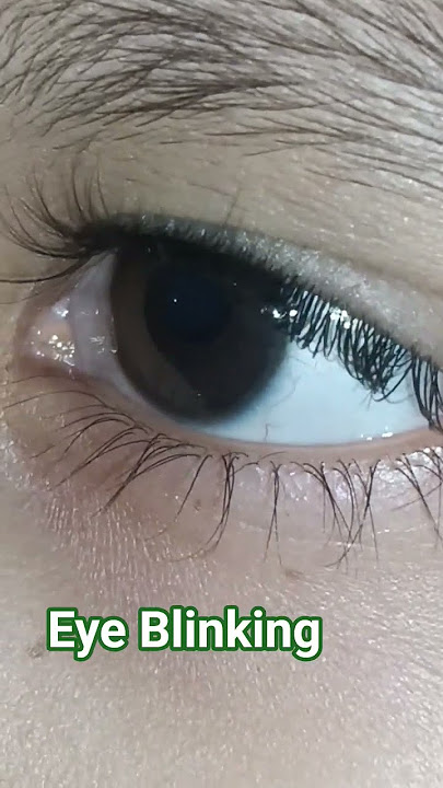 Eye Blinking 👀👁️🧑‍⚕️#viral #viralvideo !!tery aakho me phaila #ytshorts