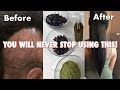 do not USE this hair treatment if you’re not ready for Extreme HAIR growth!