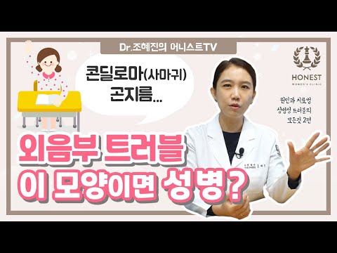 외음부 트러블! &rsquo;이 모양&rsquo;이면 &rsquo;성병&rsquo;👿 | 곤지름,콘딜로마(사마귀),헤르페스 2탄