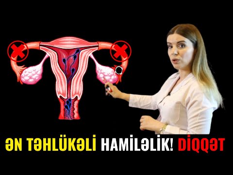 Video: İnteryeri süni xəzlə bəzəyin