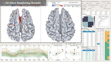 A Predictive Visual Analytics System for Studying Neurodegenerative Disease based on DTI Fiber Tract
