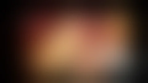 total laparoscope gastrectomy 腹腔镜胃癌根治全胃切除术 - 天天要闻