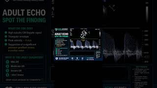 Adult echo quiz #ecginterpretation #echocardiography