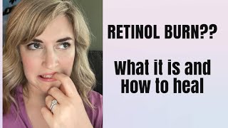 RETINOL IRRITATION | WHAT IT IS AND HOW TO FIX IT ASAP