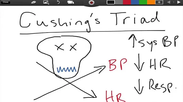 Cushing's Triad - ICP - EMTprep.com