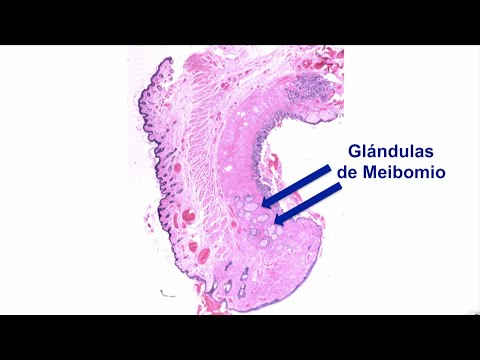 Video: ¿Cuál es el nombre de las glándulas) que recubren el margen del párpado?