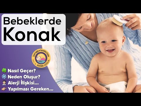 Bebeklerde Konak Nasıl Geçer (Doğal Yağlarla Tedavi, Sebep, Allerji İlişkisi)