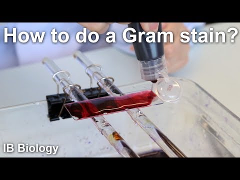 How to Do a Gram Stain? - Biology Lab Techniques