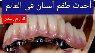 أحدث طقم أسنان في العالم متوفر الآن في مصر 🇪🇬 Titanium Denture تركيبات الأسنان