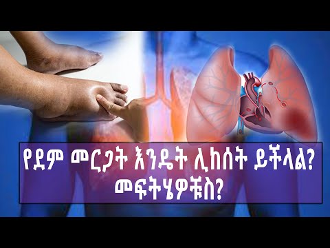 ቪዲዮ: በክንድዎ ውስጥ DVT ን ለማከም 3 መንገዶች