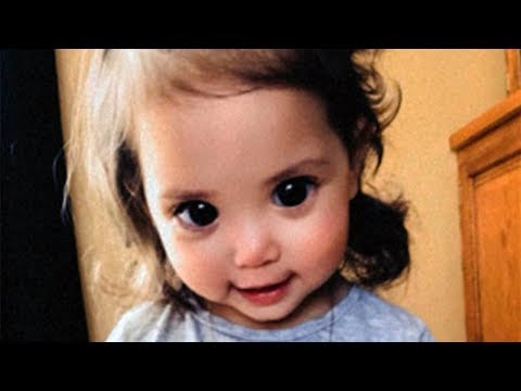 Video: Due To A Rare Genetic Malfunction, The Girl Has Frighteningly Huge Pupils In Her Eyes - Alternative View