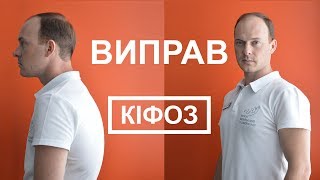 Як виправити кіфоз