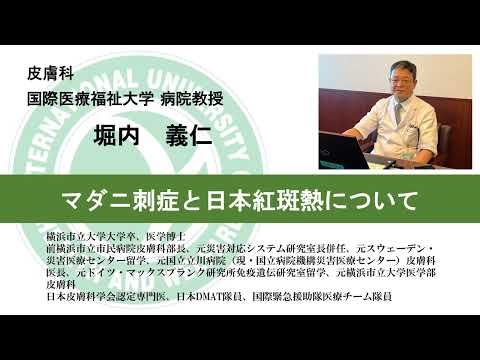 国際医療福祉大学熱海病院　オンライン健康講座「マダニ刺傷と日本紅斑熱について」　堀内義仁　皮膚科部長　病院教授（10分05秒）