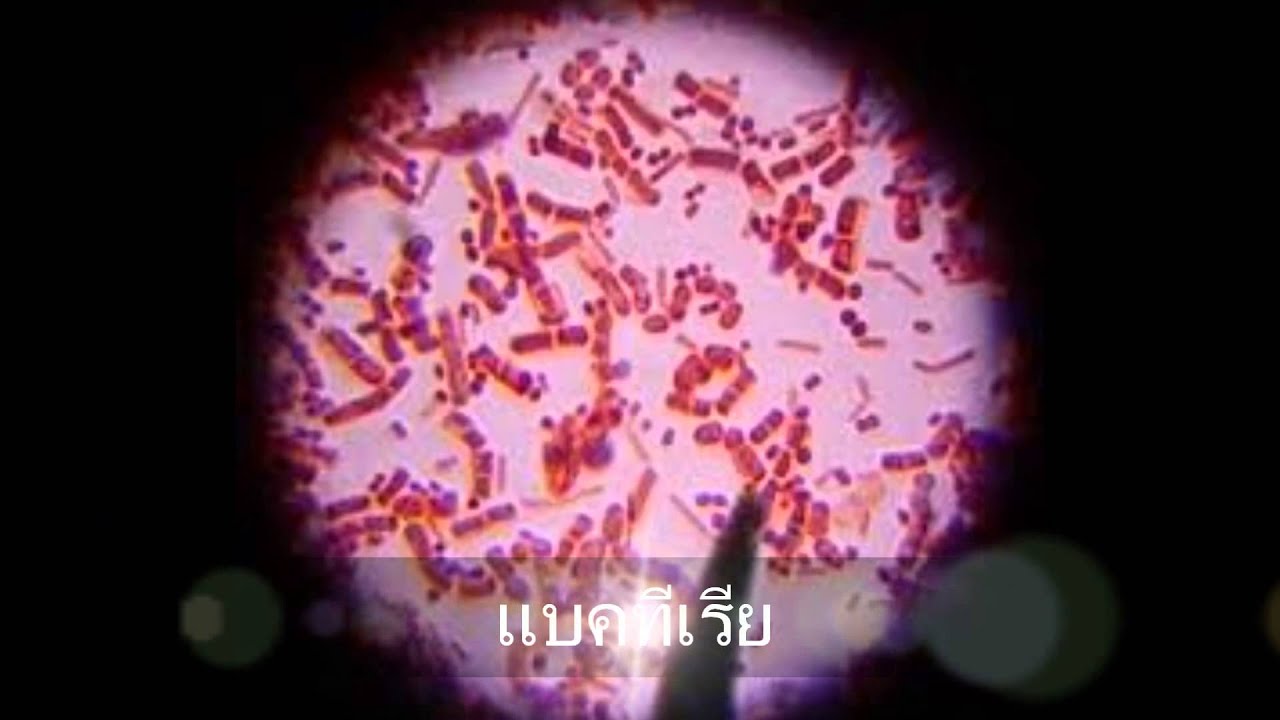 Сальмонеллез и брюшной тиф. Бактерия сальмонелла Тифи. Salmonella typhi микроскопия. Возбудитель брюшного тифа микробиология. Сальмонелла брюшного тифа.