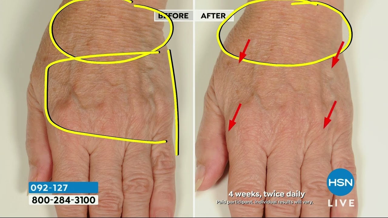 NassifMD HydroScreen Serum with Hyaluronic Acid, Retinol...