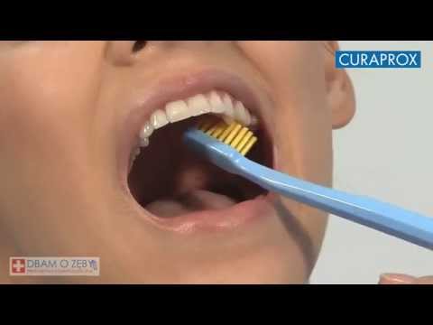Wideo: Jak wzmocnić zęby, jeśli są zniszczone: przyczyny zaburzeń struktury zęba, skuteczne metody i porady dentysty