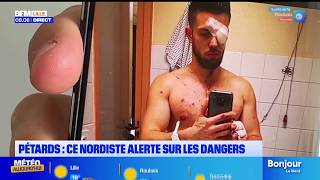 Kévin, devenu malvoyant après l’explosion d’un pétard, témoigne pour faire de la prévention