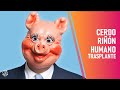 [VIDEO] Trasplantan riñón de CERDO en un HUMANO