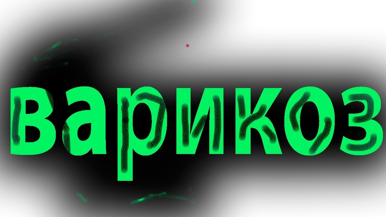 Варикозная болезнь. Как растворить тромб в вене.Лечение тромбофлебита ...