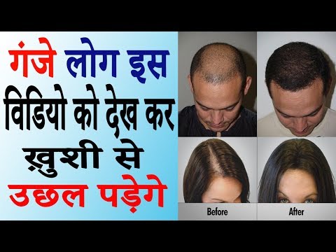 वीडियो: स्टास सैडल्स्की ने एसमस की भूमिका के लिए गंजेपन की इच्छा का उपहास किया