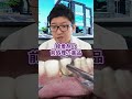 虫歯の歯を樹脂でキレイに復元する治療を先生が説明！【吉岡歯科医院】