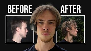 Why you can Still Remodel your Skull After Puberty ( And How to Do It )
