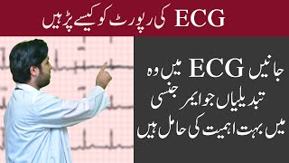 ECG - EKG | Reading ECG | How to read ECG in Urdu? | ECG Ki Report Kaise Dekhe? screenshot 5