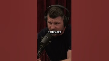 How Michael Bisping LOST an Eye