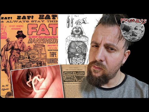 Would you eat a parasite to lose weight? The Horrors of the Victorian Tapeworm Diet | Frumess by Frumess