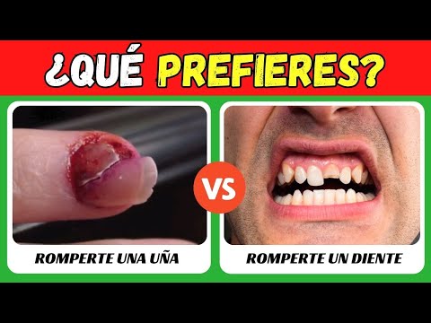 ¿Qué PREFIERES? 🤯