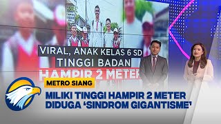 Viral! Anak Kelas 6 SD Tinggi Badan Hampir 2 Meter!