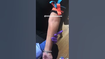 Three Finger Tucking Technique For Forearm IVs