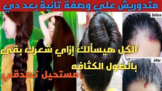 تكثيف الشعر/ملأ الفراغات/تطويل الشعر/علاج القشرة/تنعيم الشعر/تقوية الشعر وصفه هتغنيكي عن البروتين