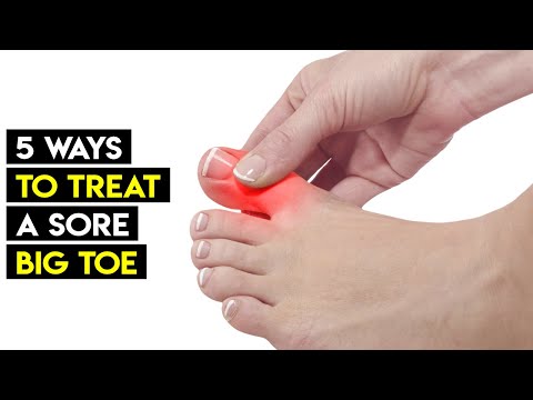 Swollen Toe: 5 Ways to Treat a Sore Big Toe Naturally