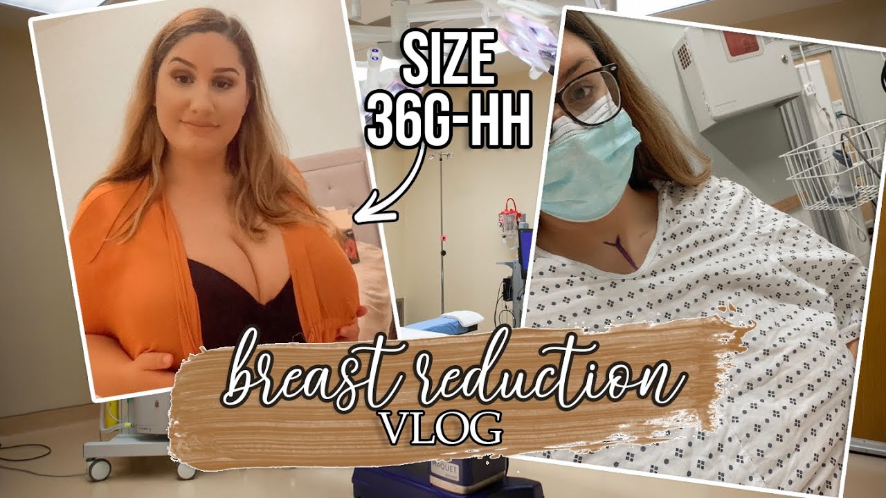 MY BREAST REDUCTION SURGERY VLOG!