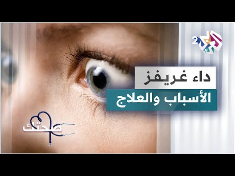 داء غريفز بين الأسباب والتشخيص والعلاج