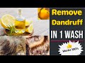 1 WASH CHALLENGE: Remove Dandruff in Just 1 Wash  | Dandruff Treatment at Home | Preity प्रेरणा
