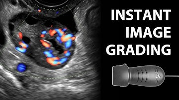 Automated Ultrasound Image Assessment from SonoSim