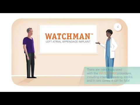 Watchman Patient Animation 60seconds