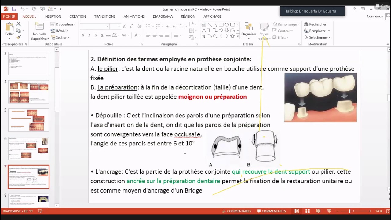 1 examen clinique et plan de traitement en prothese conjointe