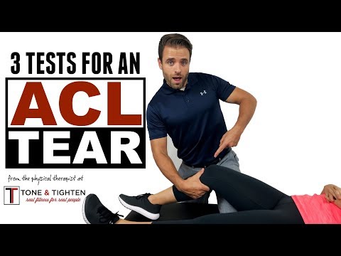 Video: 3 způsoby, jak potvrdit částečnou slzu ACL