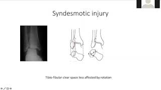 Case discussion Ankle
