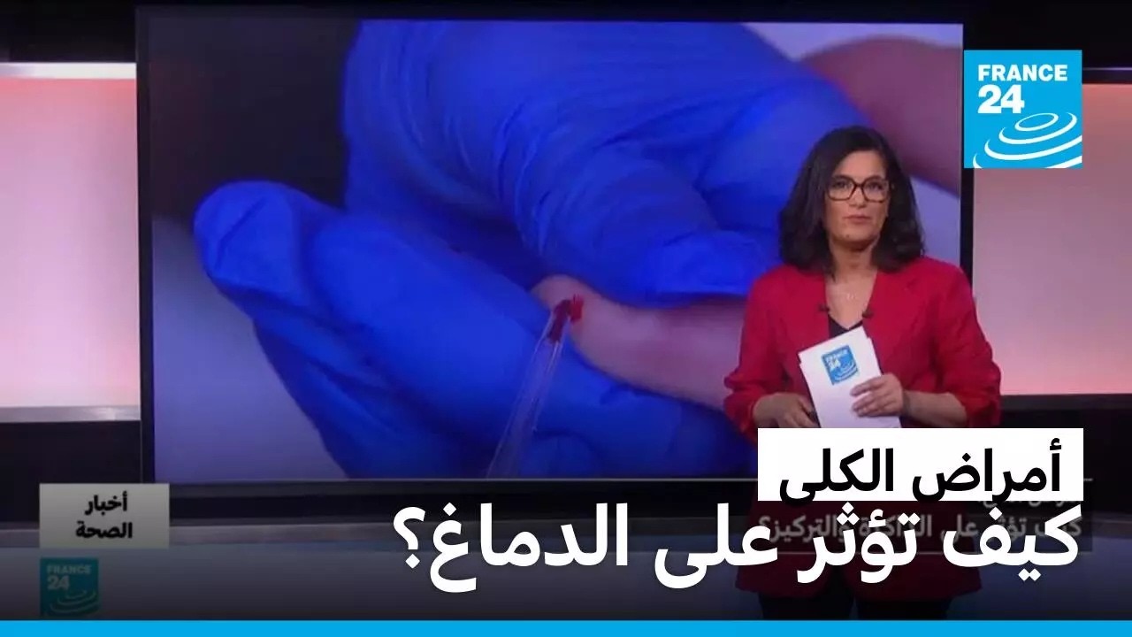����� �����.. ��� ���� ��� �����ۿ � ����� 24 / FRANCE 24
 - نشر قبل 9 دقيقة
