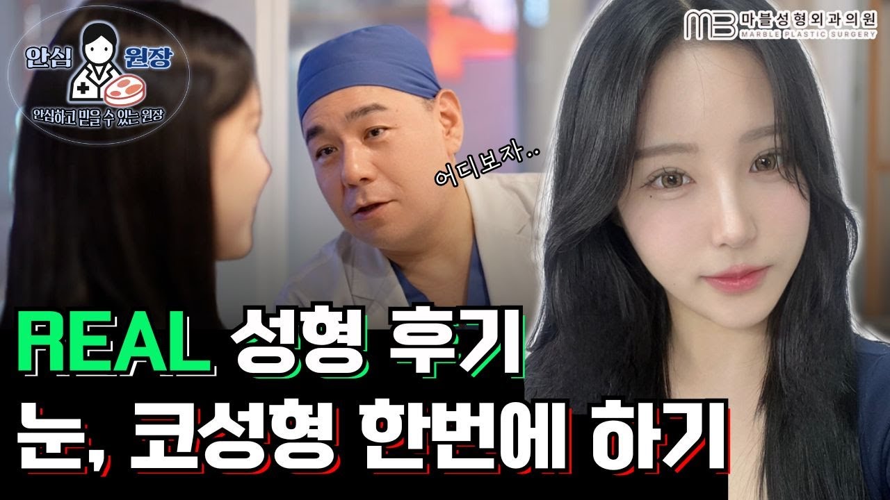 [눈성형+무보형물 코끝성형] 의느님 덕분에 변신했어요....♥ 실제환자 리얼 리뷰영상