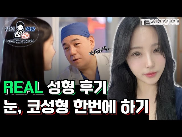 [눈성형+무보형물 코끝성형] 의느님 덕분에 변신했어요....♥ 실제환자 리얼 리뷰영상