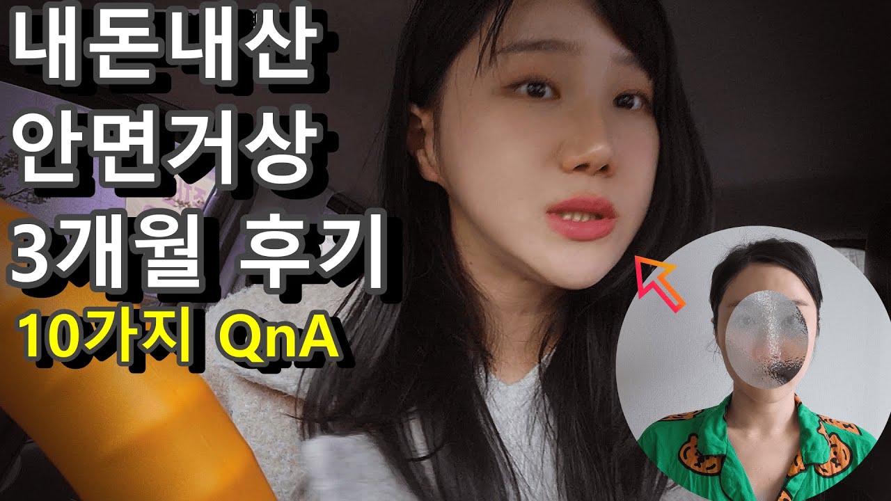 내돈내산 안면거상 3개월 후기 10가지 QnA
