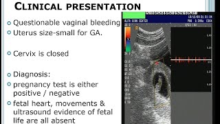 ABORTION / obstetrics / Gynecology
