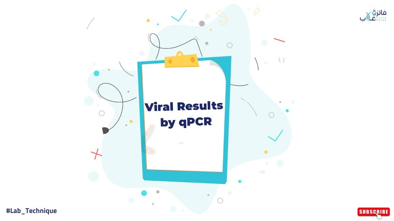 Viral result by Real time-PCR